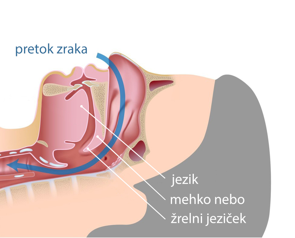 Primerjava normalnega dihanja in smrčanja zaradi ovirane dihalne poti
